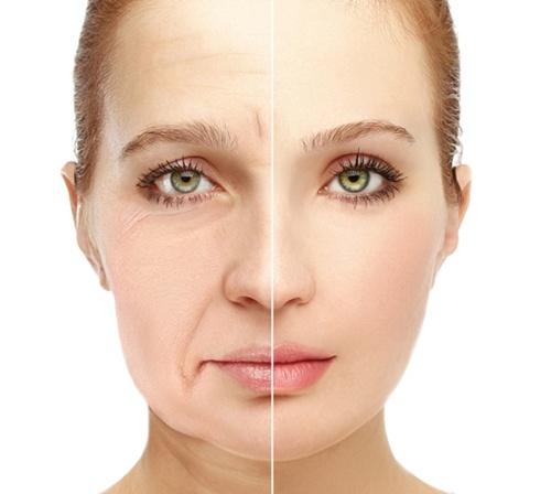 脸部松弛下垂做什么运动可以改善(面部松弛下垂的最好锻炼方法)-艺快